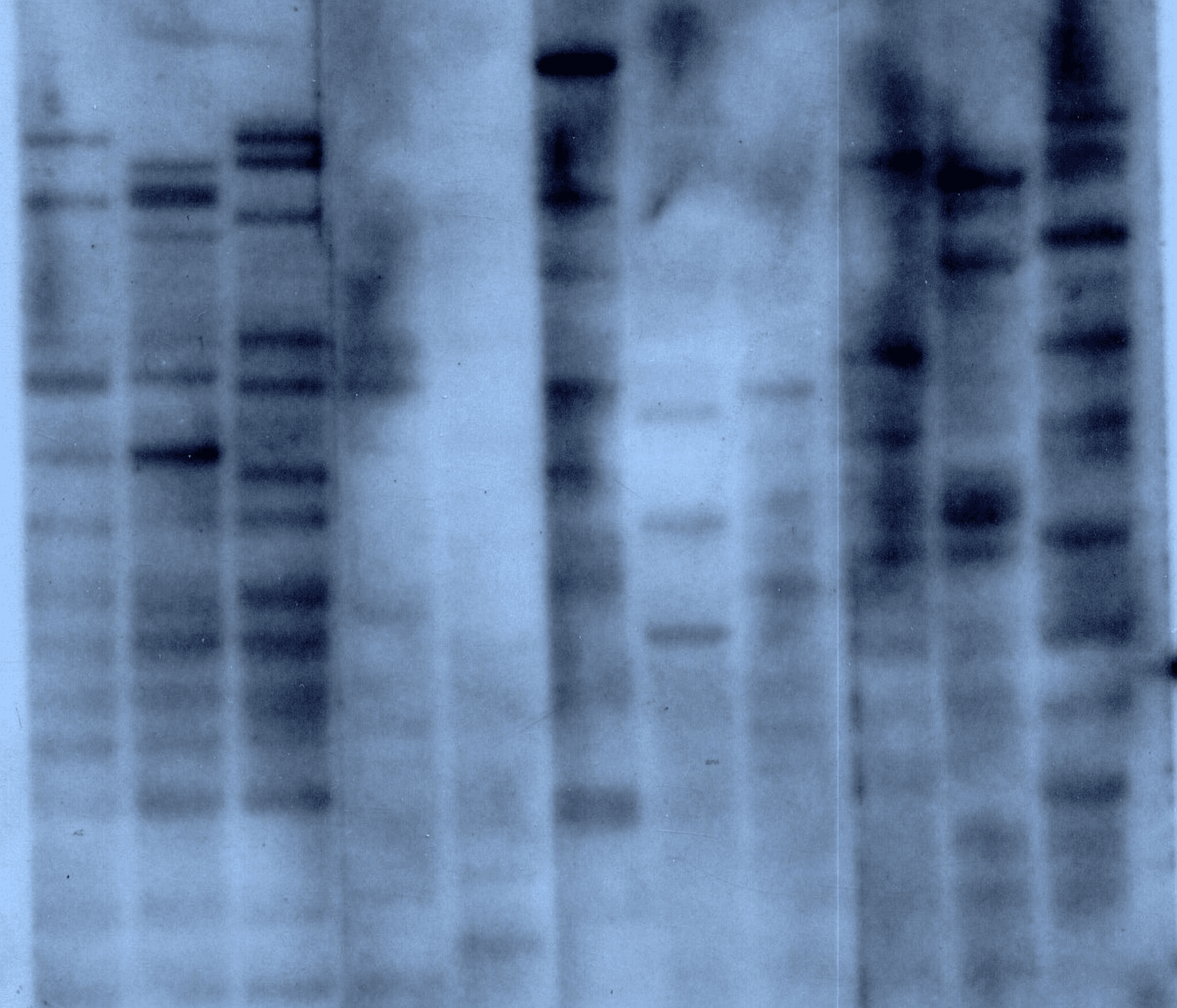 “The first DNA fingerprint. The first three lanes contain DNA from a woman, her mother and her father respectively. Lanes 4 - 11 contain DNA from assorted other species including mouse, baboon, lemur, cow, grey seal and tobacco (last lane). The DNA probe used in this experiment detected tandemly repeated short stretches of DNA called minisatellites whose length varies between individuals”. Alec Jeffreys -