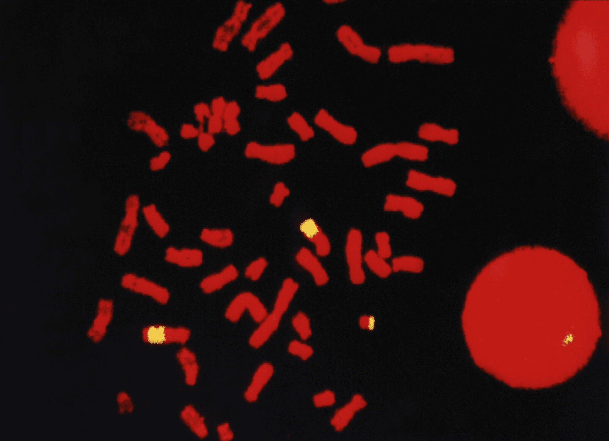 DNA probe for human/hamster hybrid DNA. Dr Rosemary Ekong, UCL